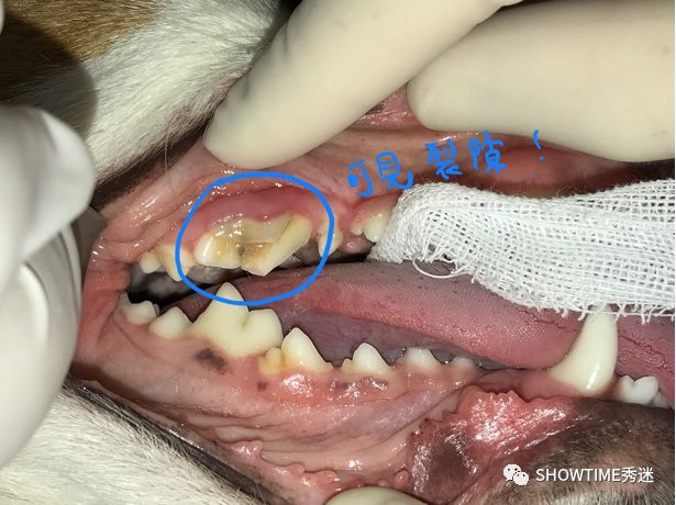 猎奇钢牙套——一切都是为了让牙齿“活”下来。「919爱牙科普行动」