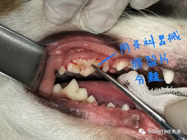 猎奇钢牙套——一切都是为了让牙齿“活”下来。「919爱牙科普行动」