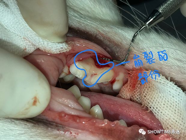 猎奇钢牙套——一切都是为了让牙齿“活”下来。「919爱牙科普行动」