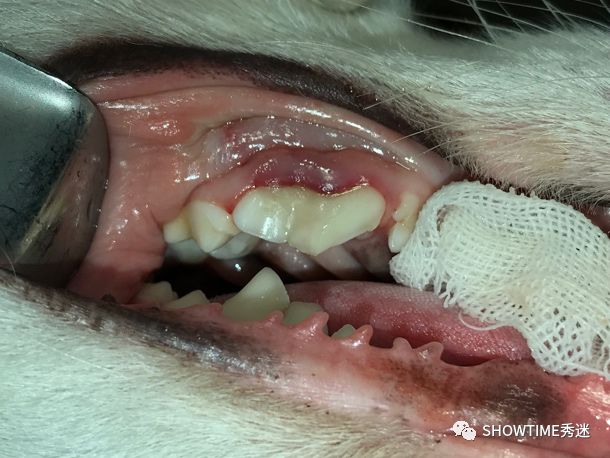 猎奇钢牙套——一切都是为了让牙齿“活”下来。「919爱牙科普行动」