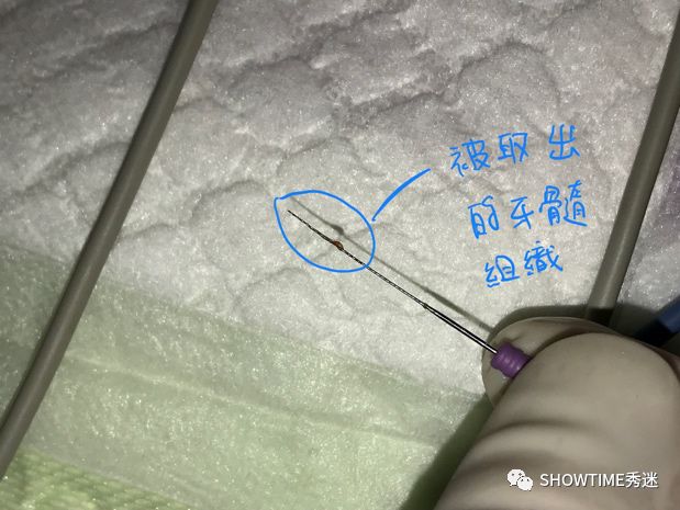 猎奇钢牙套——一切都是为了让牙齿“活”下来。「919爱牙科普行动」