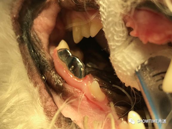 猎奇钢牙套——一切都是为了让牙齿“活”下来。「919爱牙科普行动」