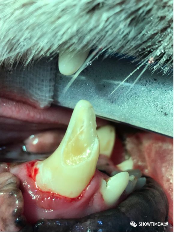 猎奇钢牙套——一切都是为了让牙齿“活”下来。「919爱牙科普行动」