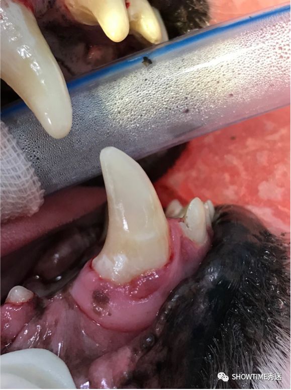 猎奇钢牙套——一切都是为了让牙齿“活”下来。「919爱牙科普行动」
