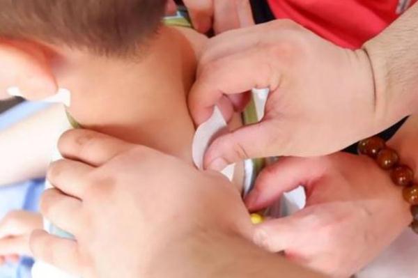 宝宝被蚊虫叮咬后有什么解决办法,宝宝被蚊虫叮咬后怎么处理