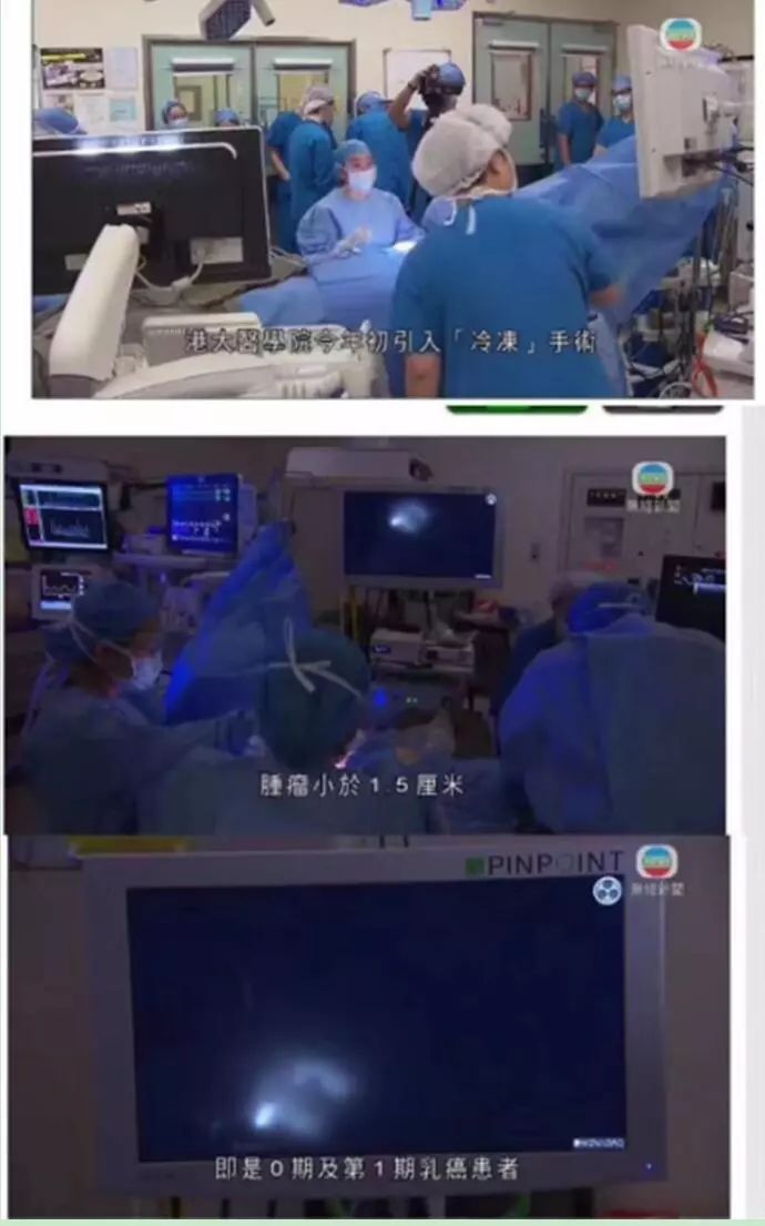 冷冻治疗八次又复发,冷冻复苏成功案例