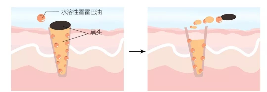 怎样高效快速去黑头,如何快速高效的去黑头