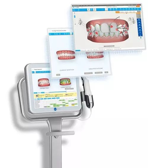 别人矫牙1万起，广州只要3960元！仅限2天