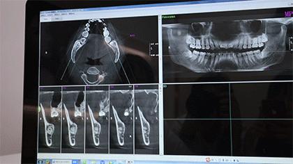 暑期矫牙季来啦你准备好了吗,暑期矫牙特惠
