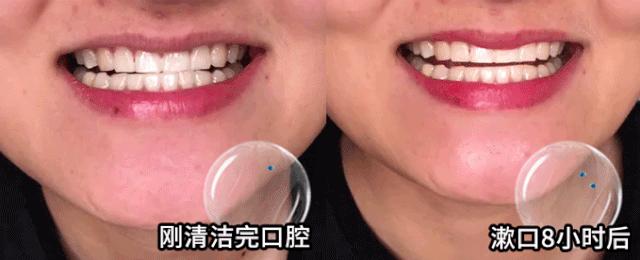 秒除口臭,一秒解决当天口臭