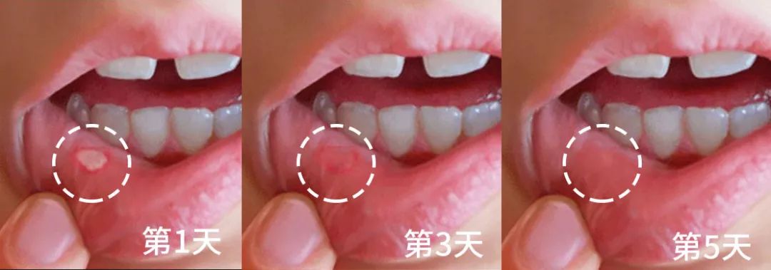 秒除口臭,一秒解决当天口臭