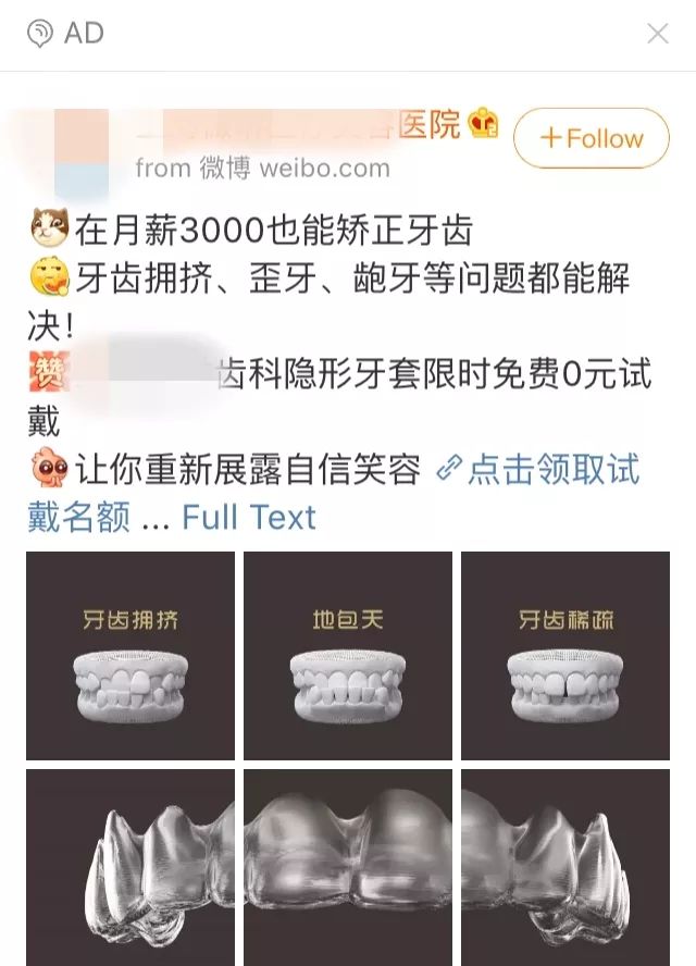 大龄整牙,错过生长发育期怎么办