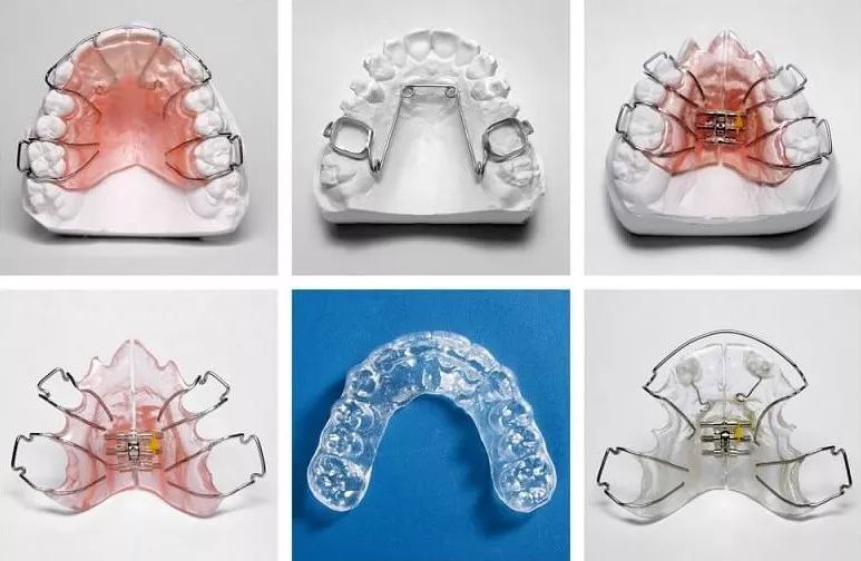 大龄整牙,错过生长发育期怎么办