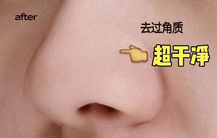 脸上搓出3斤泥！难怪又黄又暗又黑头！10秒给脸蛋“剥壳”，厉害