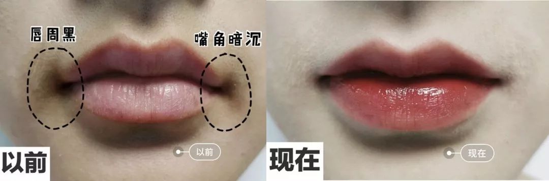 脸上搓出3斤泥！难怪又黄又暗又黑头！10秒给脸蛋“剥壳”，厉害