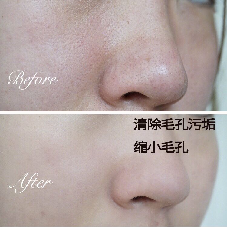 脸上搓出3斤泥！难怪又黄又暗又黑头！10秒给脸蛋“剥壳”，厉害