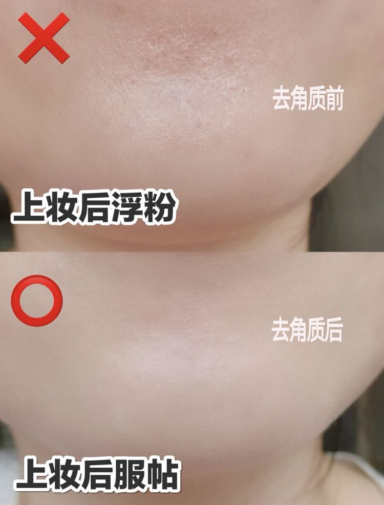 脸上搓出3斤泥！难怪又黄又暗又黑头！10秒给脸蛋“剥壳”，厉害