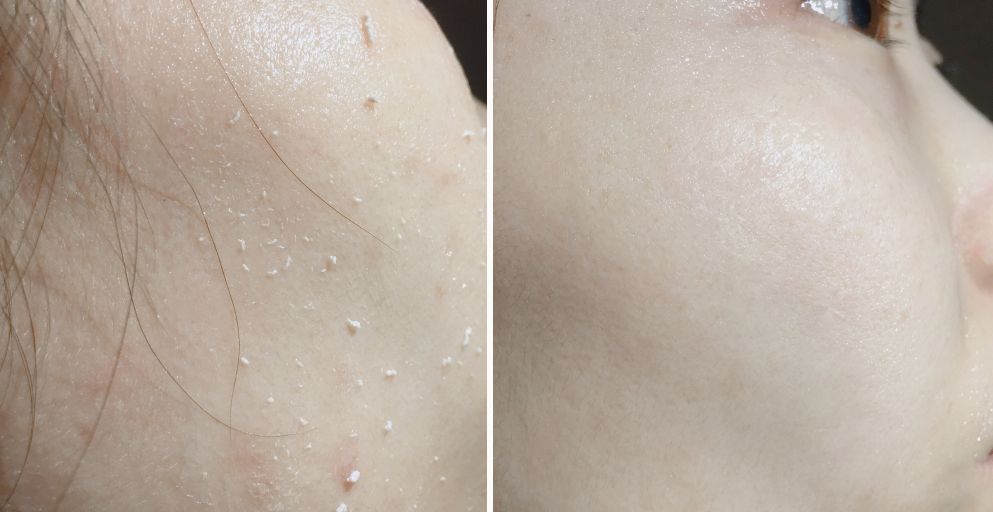 脸上搓出3斤泥！难怪又黄又暗又黑头！10秒给脸蛋“剥壳”，厉害