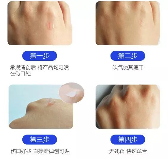 比创可贴好用,最好用的液体创可贴