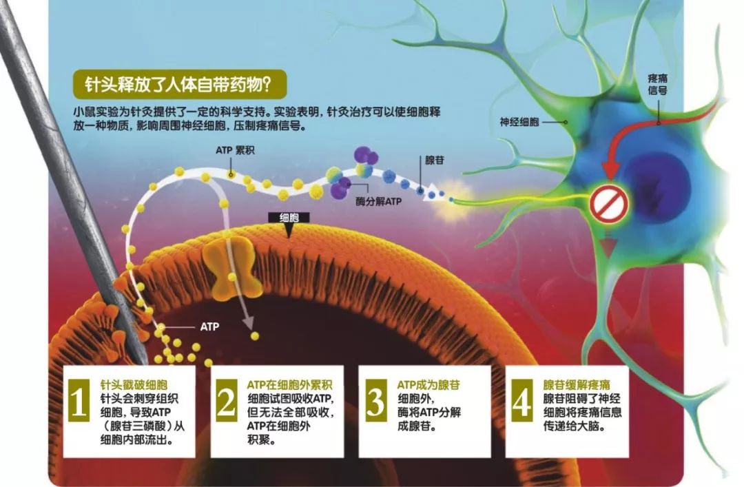 针灸是不是中医精髓,针灸是科学还是伪科学