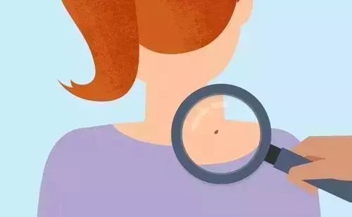 身上最近出了很多黑痣有危险没,身体上出现什么黑痣需要注意