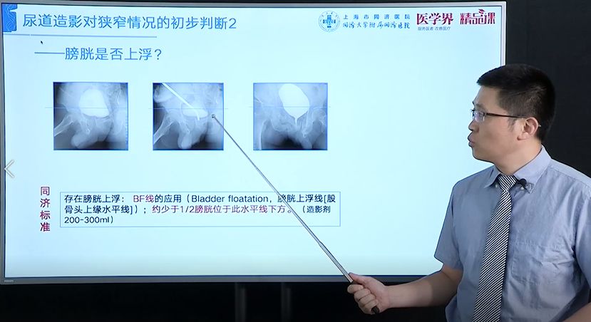 泌尿外科医生的「尿道修复重建」超实用锦囊