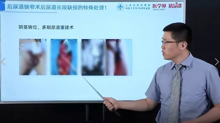 泌尿外科医生的「尿道修复重建」超实用锦囊