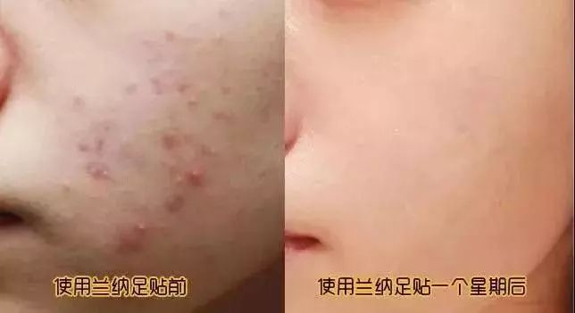 湿气重做什么动作可以排湿,湿气重的懒人方法