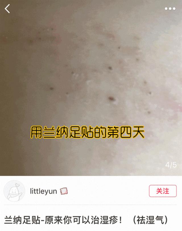 湿气重做什么动作可以排湿,湿气重的懒人方法