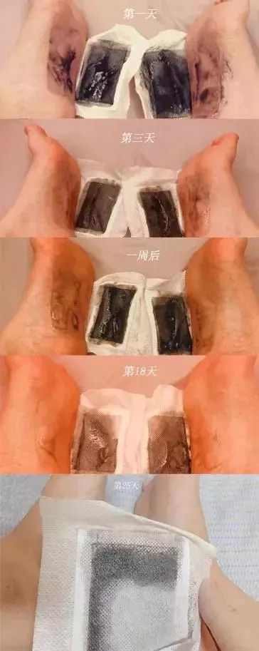 湿气重做什么动作可以排湿,湿气重的懒人方法