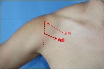 肩周炎讨人嫌,轻轻一灸治疗解烦忧