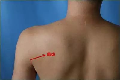 肩周炎讨人嫌,轻轻一灸治疗解烦忧