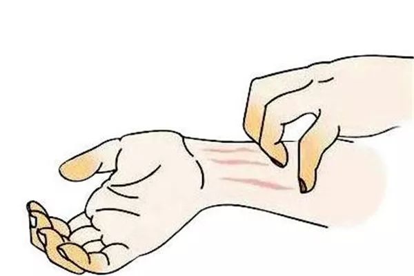 湿疹高发期，外用药膏种类太多了，到底抹点啥呢？