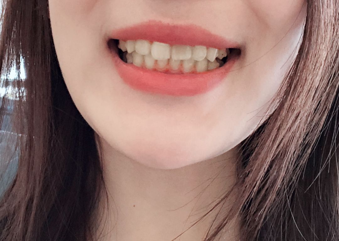 韩商言吐血了,韩商言的高光时刻