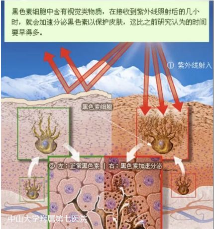 越晒越白越好的防晒方法,一白遮百丑夏日防晒大科普