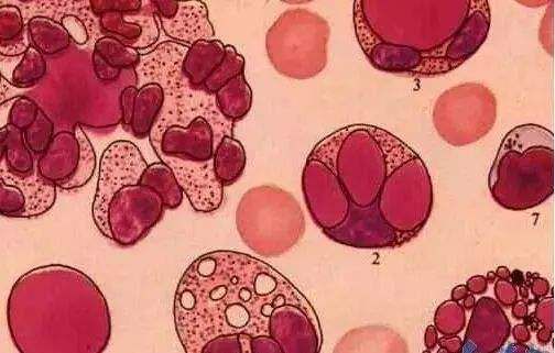 岭南妇科养生坊｜一位月经少的女孩被“劝说”做排毒治疗，到医院一求证，才知道自己差点被骗！