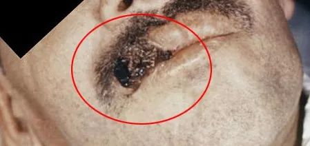 鸟屎为什么有青的,鸟屎为什么是一条条的