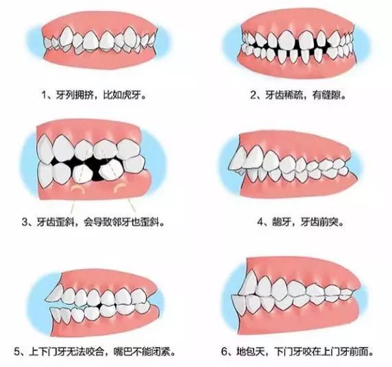 暑期矫牙季来啦你准备好了吗,暑期矫牙特惠