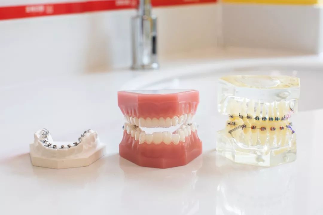 暑期矫牙季来啦你准备好了吗,暑期矫牙特惠