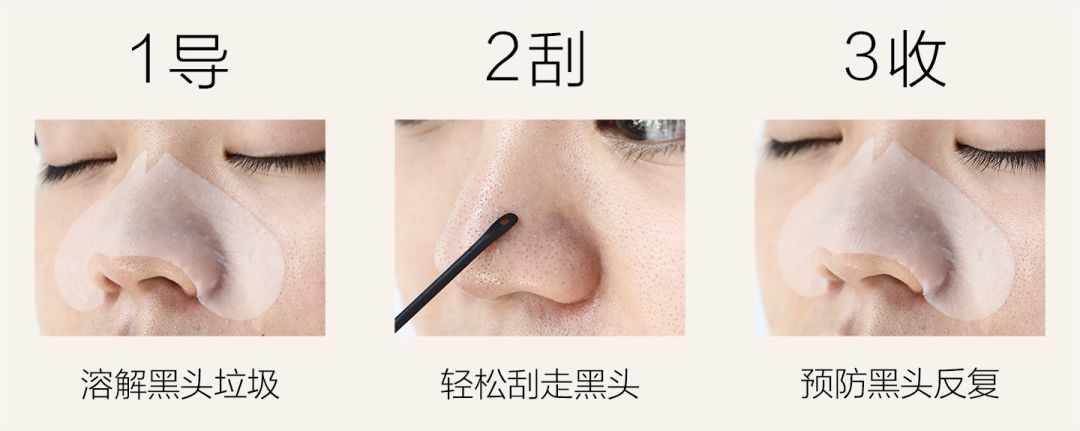 黑头用黑头膏为什么去不掉黑头,清洁黑头推荐用黑头仪还是黑头铲
