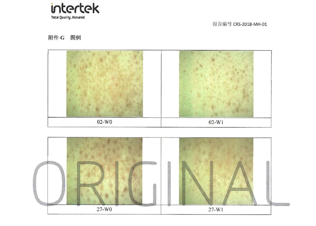 皮肤干燥起皮的救星,皮肤干燥起皮怎么办用什么护肤品