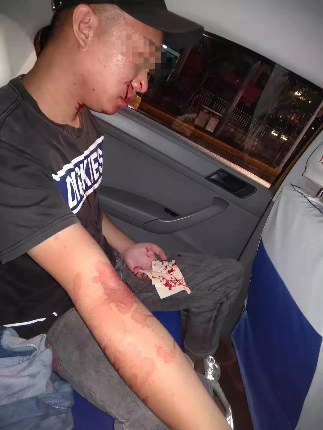 被狗咬要求赔偿5万块过分吗,被人家狗咬了应该赔偿多少钱