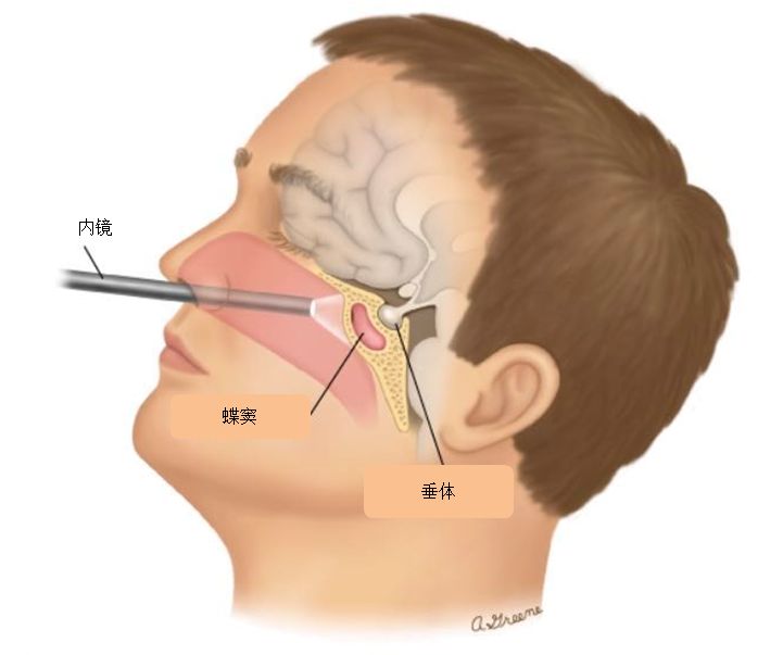 什么？！打嗝止不住是脑子有问题？