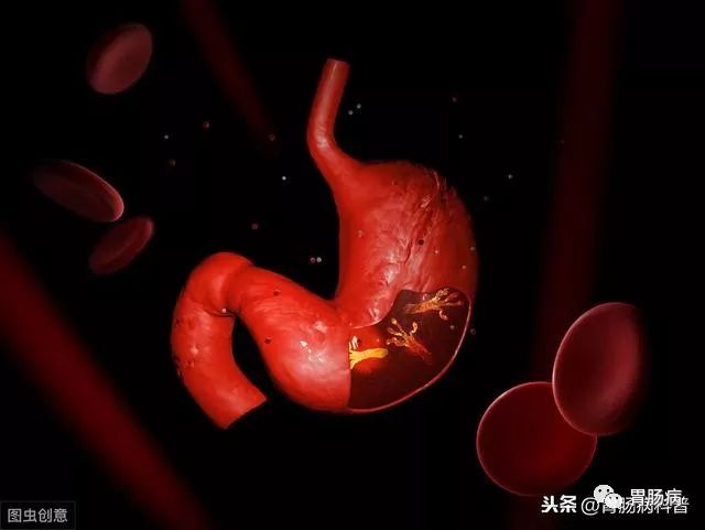 网上说幽门螺杆菌是胃癌的元凶,我查出来阳性,但没有症状,会不会得胃癌?要不要治疗?