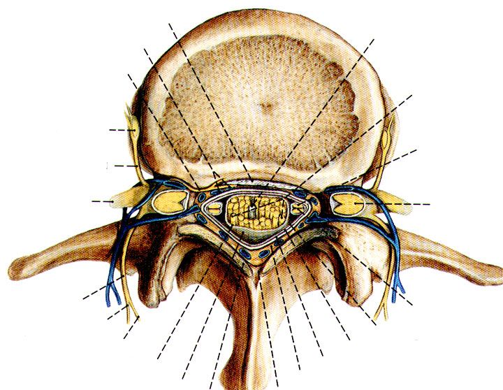 腰疼椎管狭窄压迫神经怎么治疗,腰疼椎管狭窄有什么办法