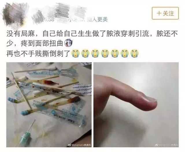 一个没注意，手指倒刺变截指！这个动作千万别再做了！