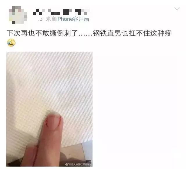 一个没注意，手指倒刺变截指！这个动作千万别再做了！