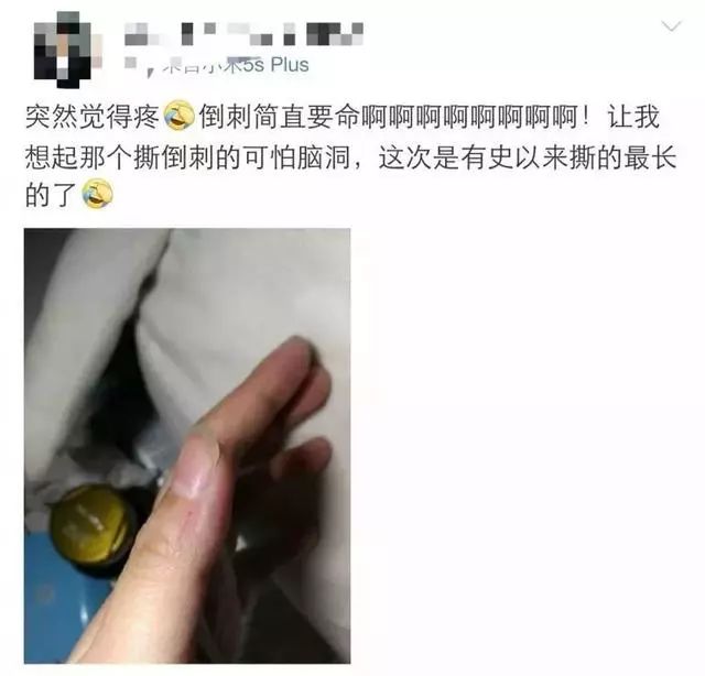 一个没注意，手指倒刺变截指！这个动作千万别再做了！