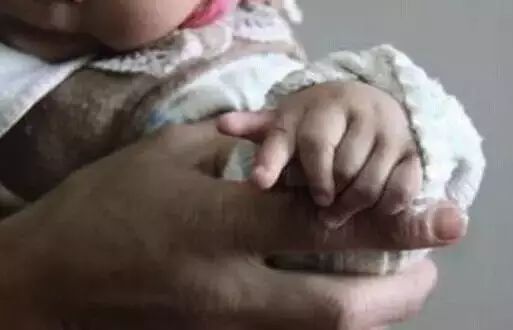 婴儿手脚畸形没查出来,新生儿手指畸形产检医院有责任么