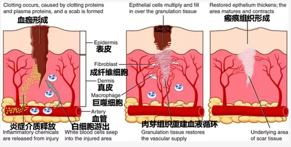 祛疤痕最快最有效的方法安全,怎么祛疤痕最有效方法